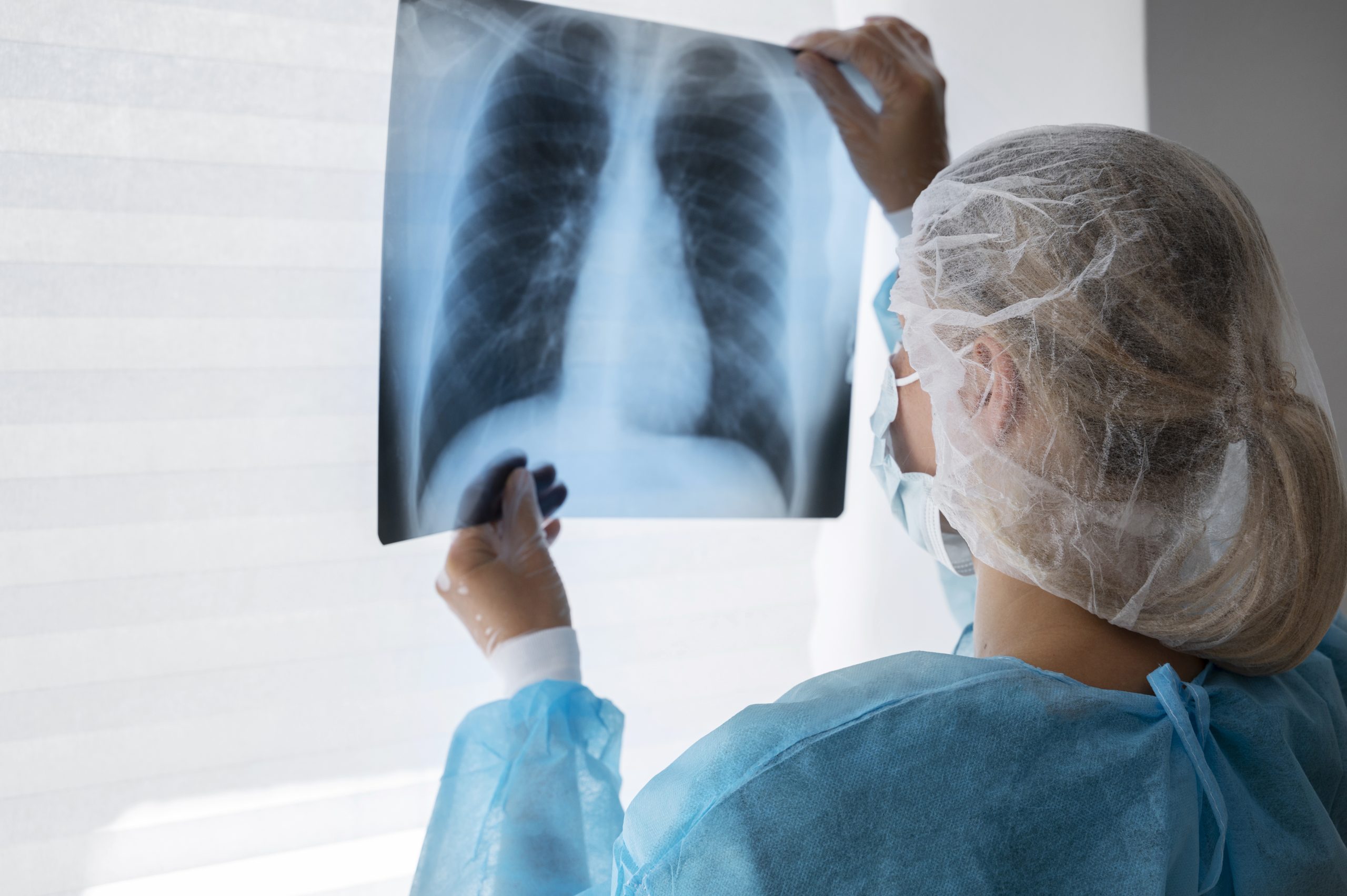 Brasil está no grupo de países responsáveis por 82% de casos de tuberculose no mundo