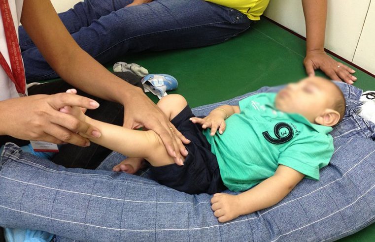 INSS inicia pagamento de indenização a vítimas do zika vírus com sequelas permanentes