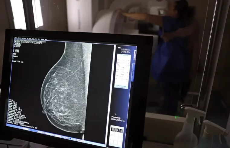 Mamografia preventiva no SUS já pode ser feito por mulheres a partir dos 40 anos