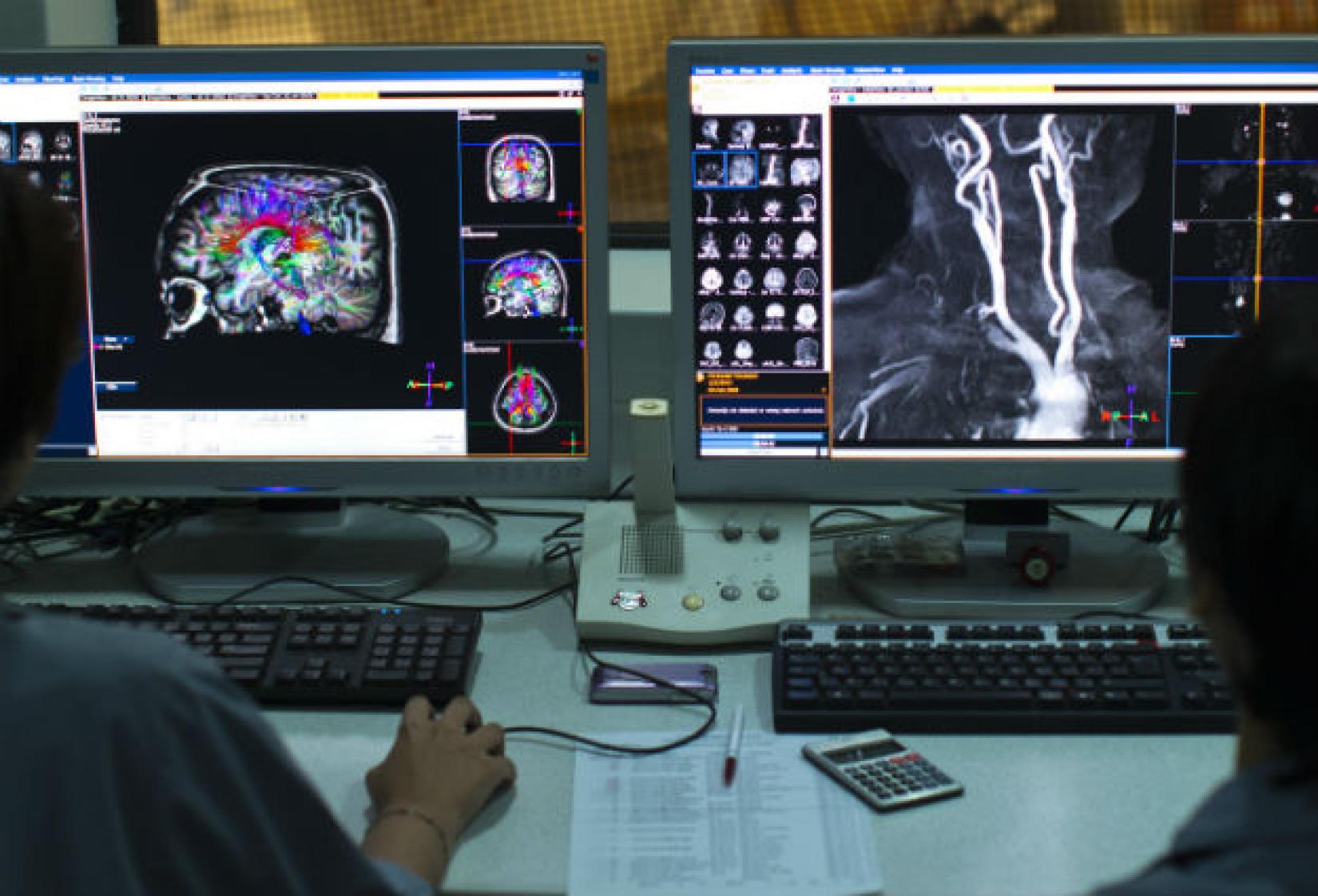 Diagnósticos de câncer devem subir 77% até 2050, alerta OMS