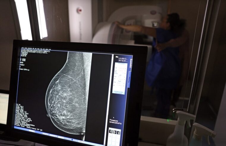 Câncer de mama ainda é o que mais mata mulheres no Brasil apesar dos avanços no rastreamento