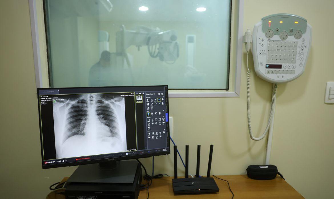 Hospitalizações por VSR e gripe crescem no Brasil; Roraima em alerta
